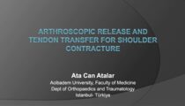 Arthroscopic release (videos) arthroscopic release and/or tendon transfer for OBP sequelae around shoulder.